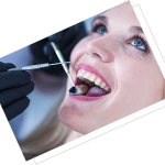 Porselen Kaplama Ankara