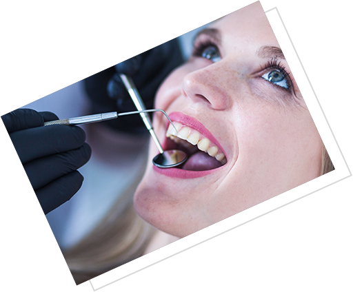 Porselen Kaplama Ankara